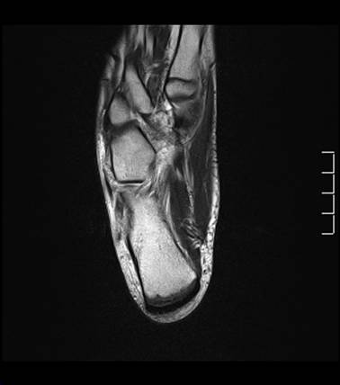 Figure 2 for case normal foot